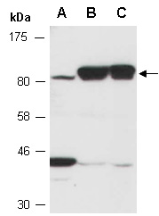 TACC1 Antibody Western (Abiocode)
