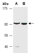 GDPD5 Antibody Western (Abiocode)