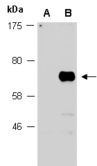 Flag-tag Western antibody (Abiocode)