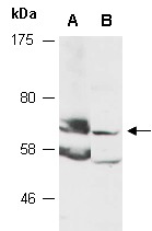 RPN1 Antibody Western (Abiocode)