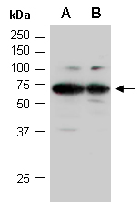 CCDC6 Antibody Western (Abiocode)