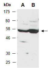 HERPUD1 Antibody Western (Abiocode)