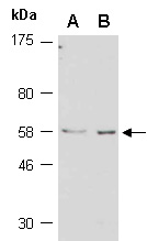 A1BG Antibody Western (Abiocode)