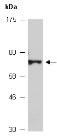 ZBTB44 Antibody Western (Abiocode)