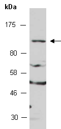 HIF2A Antibody Western (Abiocode)