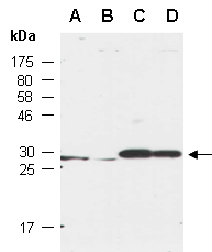 VHL Antibody Western (Abiocode)