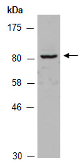 SUVR2 Antibody Western (Abiocode)