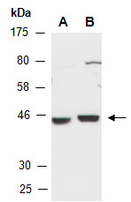 CBX8 Antibody Western (Abiocode)