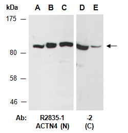 ACTN4 Antibody Western (Abiocode)