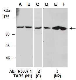 TARS Antibody Western (Abiocode)
