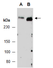 WNK1 Antibody Western (Abiocode)