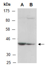 VASP Antibody Western (Abiocode)