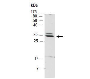 NEUROG2 Antibody Western (Abiocode)