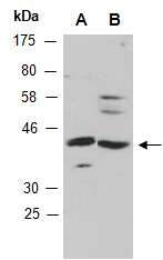 RSPO3 Antibody Western (Abiocode)