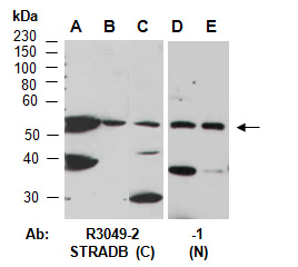 STRADB Antibody Western (Abiocode)