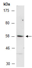 STK39 Antibody Western (Abiocode)