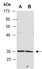 RSPO4 Antibody Western (Abiocode)