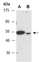 ABI1 Antibody Western (Abiocode)