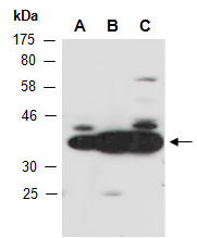 NPM1 Antibody Western (Abiocode)