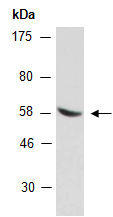 PPP3CB Antibody Western (Abiocode)