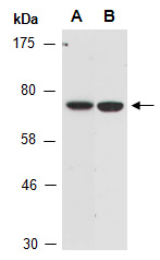 RPH3A Antibody Western (Abiocode)