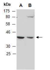RQCD1 Antibody Western (Abiocode)