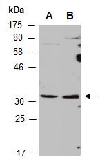 DLX5 Antibody Western (Abiocode)