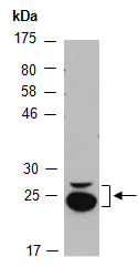 LIN7A Antibody Western (Abiocode)