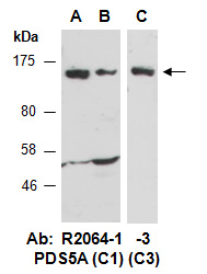 PDS5A Antibody Western (Abiocode)
