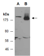 SLC12A2 Antibody Western (Abiocode)