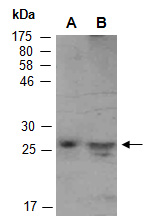 BCL2L1 Antibody Western (Abiocode)