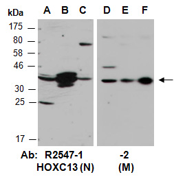 HOXC13 Antibody Western (Abiocode)