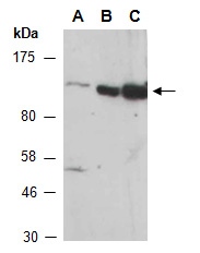 BUB1B Antibody Western (Abiocode)