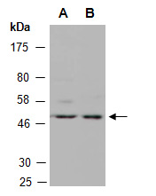 TFAP2C Antibody Western (Abiocode)