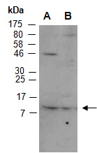 MLLT11 Antibody Western (Abiocode)