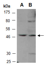 TFAP2E Antibody Western (Abiocode)