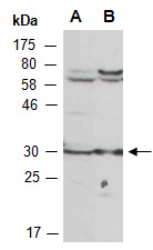 SNAI1 Antibody Western (Abiocode)