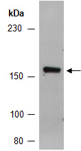 ABCC6 Antibody Western (Abiocode)