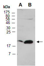 ARPP 19 Antibody Western (Abiocode)