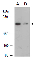 DOCK2 Antibody Western (Abiocode)