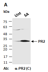 PR2 Antibody Western (Abiocode)
