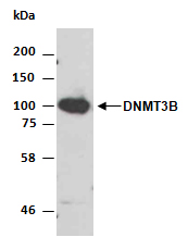 DNMT3B Antibody Western (Abiocode)