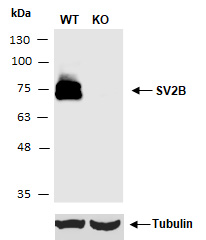 SV2B Western (Abiocode)